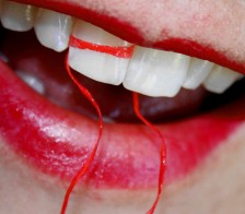 red floss